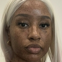 freckledn Nude