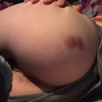 melontangie Nude