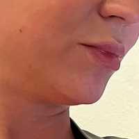 misslobatox Nude